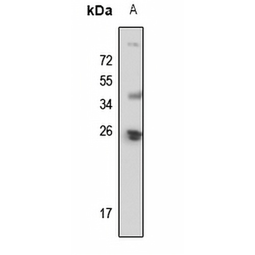 POLR2E Rabbit Polyclonal Antibody