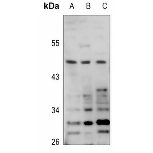POTEA Rabbit Polyclonal Antibody