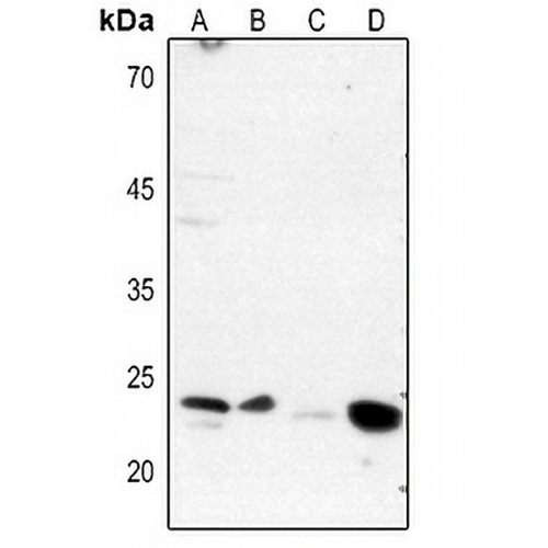 DARPP32 (Phospho-T75) Rabbit Polyclonal Antibody