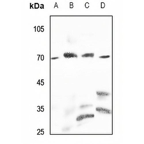 PPP2R5D Rabbit Polyclonal Antibody