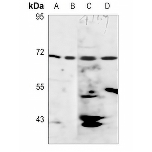 AMPK gamma 2 Rabbit Polyclonal Antibody