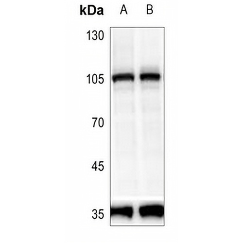 PRKD2 (Phospho-S876) Rabbit Polyclonal Antibody