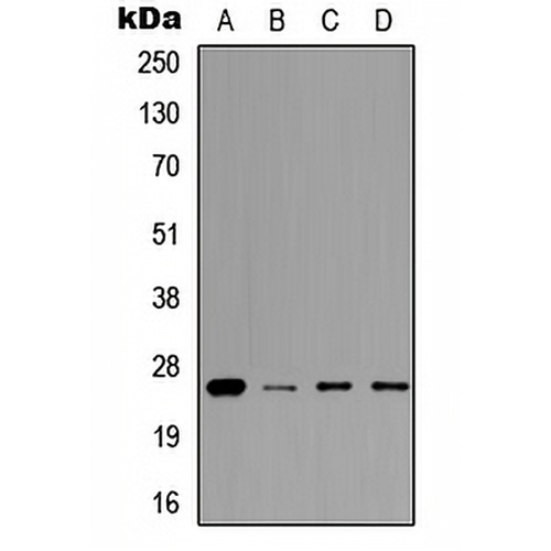 Prolactin Rabbit Polyclonal Antibody
