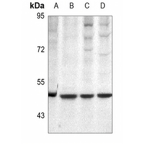 Protein C Rabbit Polyclonal Antibody