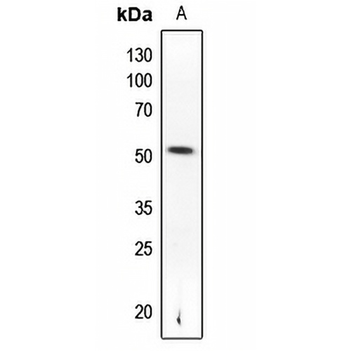 PTEN (Phospho-S370) Rabbit Polyclonal Antibody