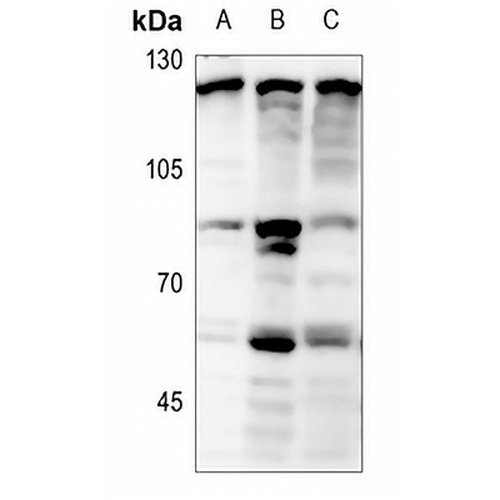 Focal Adhesion Kinase (Phospho-Y397) Rabbit Polyclonal Antibody