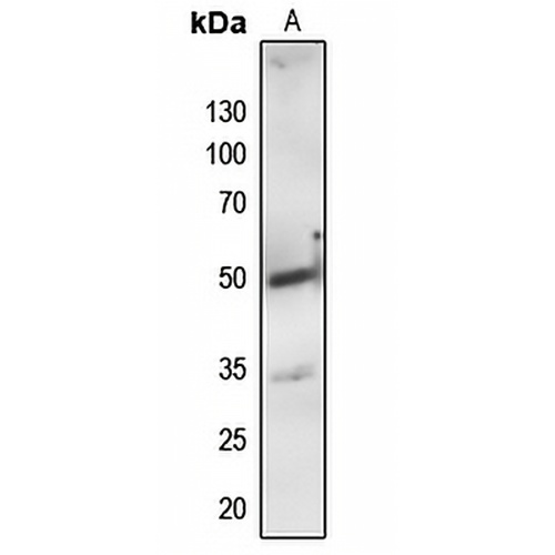 PTP1B Rabbit Polyclonal Antibody