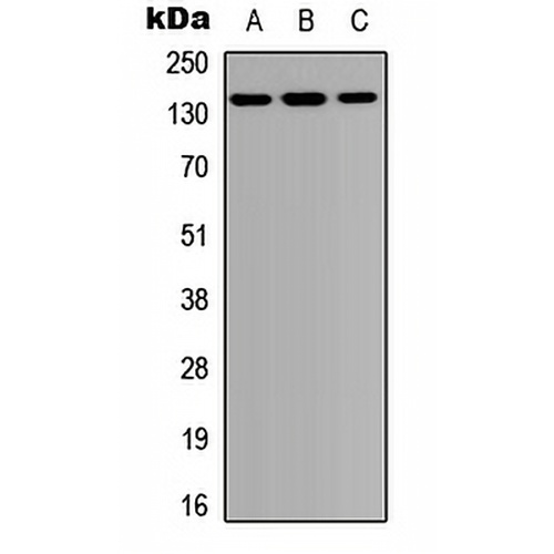 PTPD1 Rabbit Polyclonal Antibody