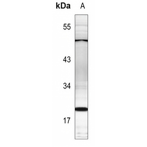 PTTG1IP Rabbit Polyclonal Antibody