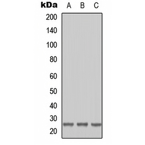 RAB41 Rabbit Polyclonal Antibody
