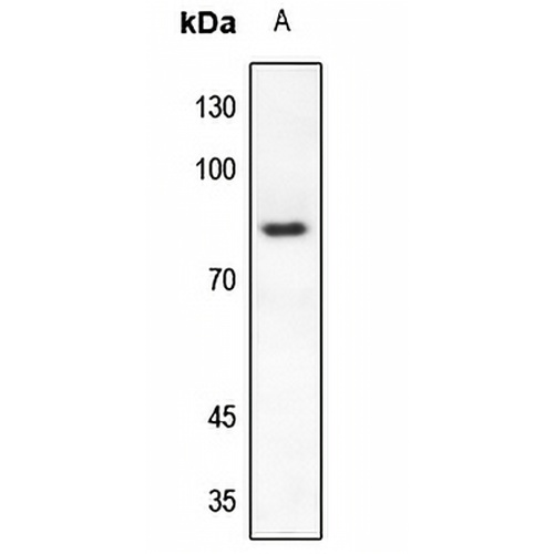 RAD17 Rabbit Polyclonal Antibody