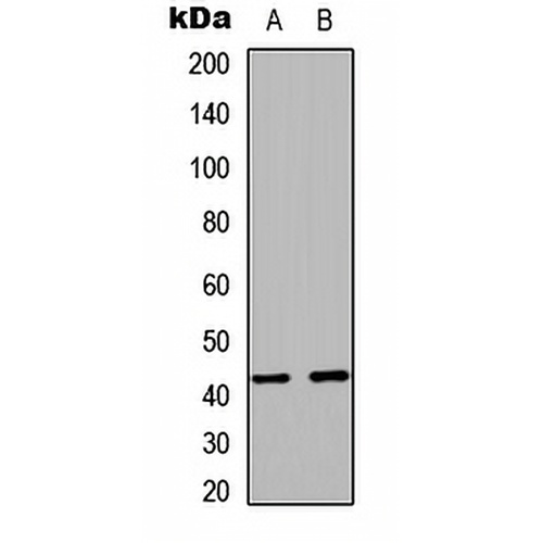 RAD51C Rabbit Polyclonal Antibody