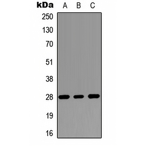 RASSF3 Rabbit Polyclonal Antibody