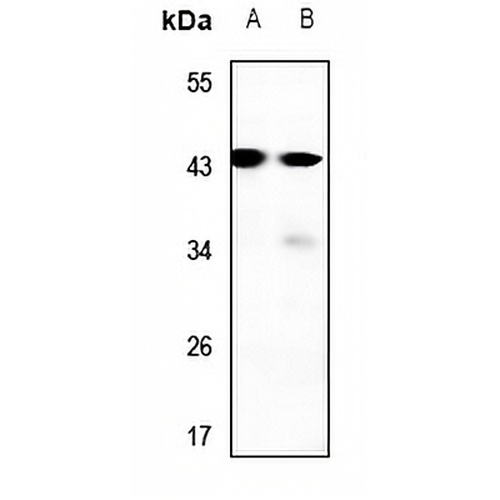 RAD52B Rabbit Polyclonal Antibody