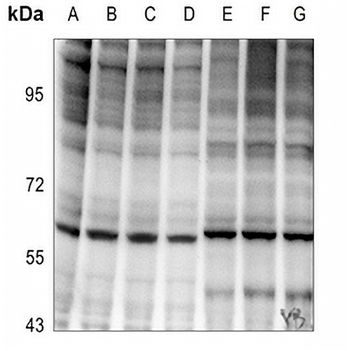 NF-kappaB p65 (Phospho-T254) Rabbit Polyclonal Antibody