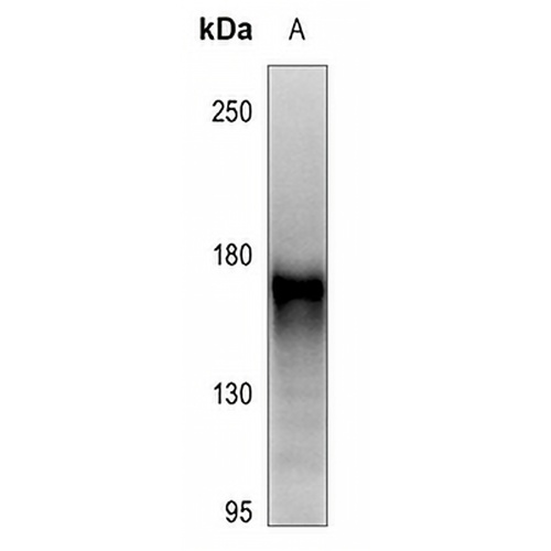 RET (Phospho-Y1062) Rabbit Polyclonal Antibody
