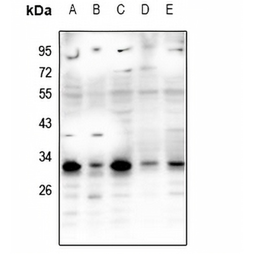 RNF138 Rabbit Polyclonal Antibody