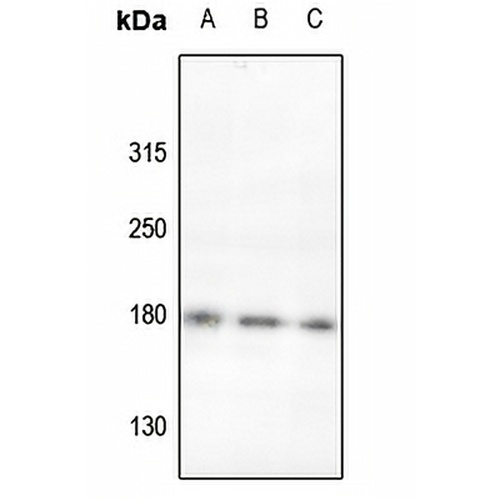 ROBO2 Rabbit Polyclonal Antibody