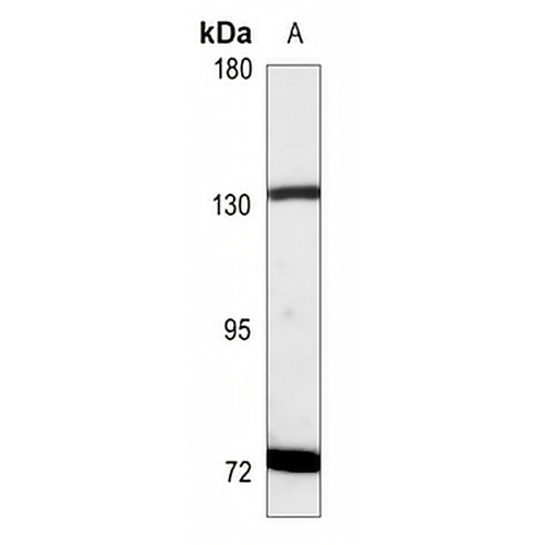 ROR2 Rabbit Polyclonal Antibody