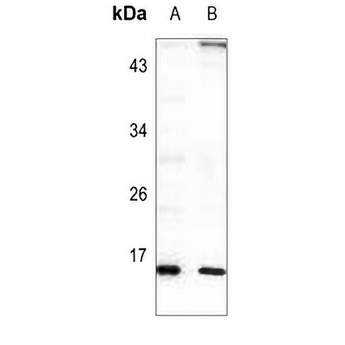 RPL22 Rabbit Polyclonal Antibody