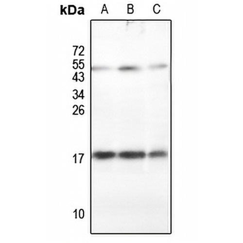 RPLP2 Rabbit Polyclonal Antibody