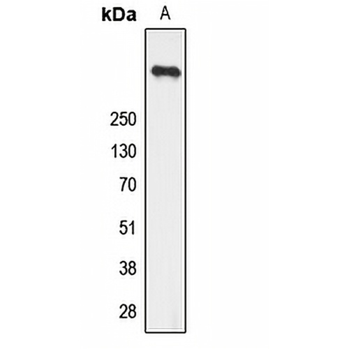 Ryanodine Receptor 2 (Phospho-S2808) Rabbit Polyclonal Antibody