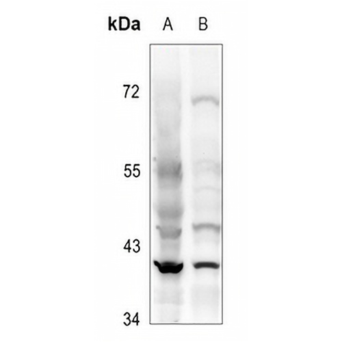 CD62L Rabbit Polyclonal Antibody
