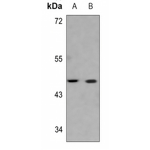 Serpin B3/4 Rabbit Polyclonal Antibody