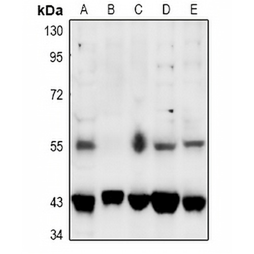 SGK1/2 (Phospho-T256/253) Rabbit Polyclonal Antibody
