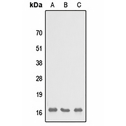 SH3BGRL3 Rabbit Polyclonal Antibody