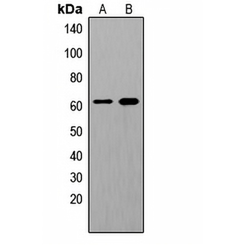 SHCA (Phospho-Y349) Rabbit Polyclonal Antibody
