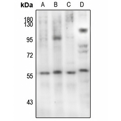 SMAD2 (Phospho-S467) Rabbit Polyclonal Antibody