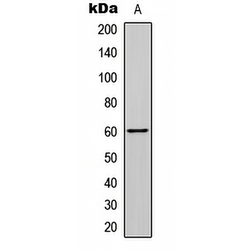SMAD2 (Phospho-S465) Rabbit Polyclonal Antibody