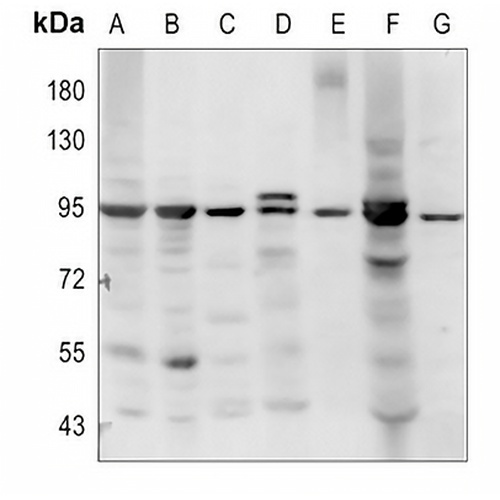 Smoothened Rabbit Polyclonal Antibody