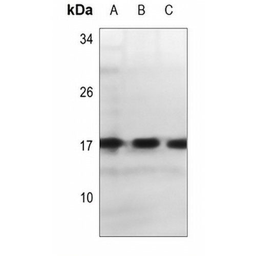 Alpha-synuclein Rabbit Polyclonal Antibody