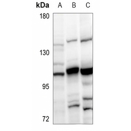 SOX6 Rabbit Polyclonal Antibody