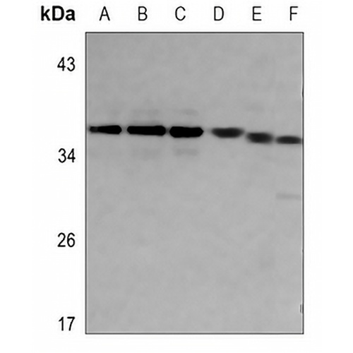 SRA Rabbit Polyclonal Antibody