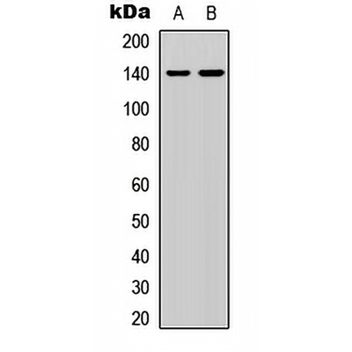 p140 Cap Rabbit Polyclonal Antibody