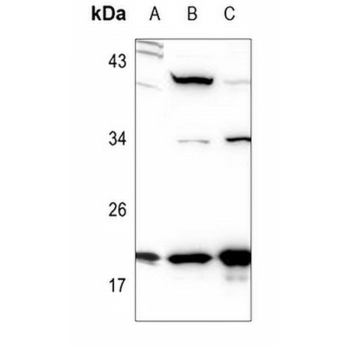 STMN1 Rabbit Polyclonal Antibody