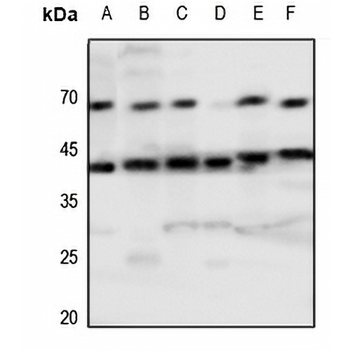 Tachykinin Receptor 1 Rabbit Polyclonal Antibody