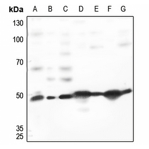 TACSTD2 Rabbit Polyclonal Antibody