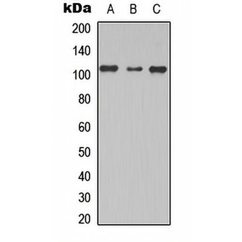 TBC1D2 Rabbit Polyclonal Antibody