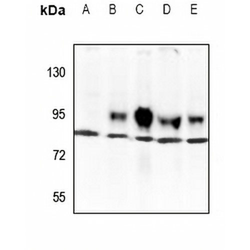 TBX3 Rabbit Polyclonal Antibody