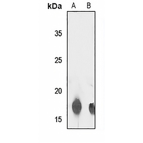TCEAL8 Rabbit Polyclonal Antibody