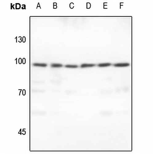 TCOF1 Rabbit Polyclonal Antibody
