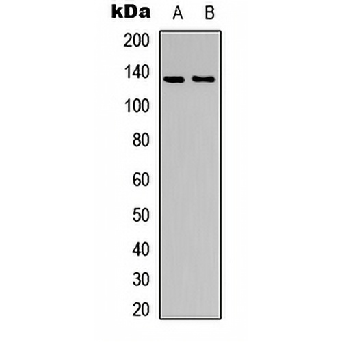 ACK1 (Phospho-Y284) Rabbit Polyclonal Antibody
