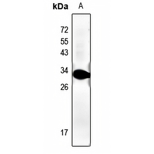 cTnI Rabbit Polyclonal Antibody