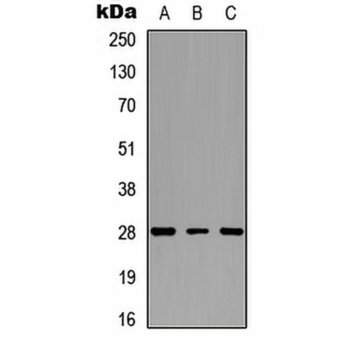 cTnI Rabbit Polyclonal Antibody