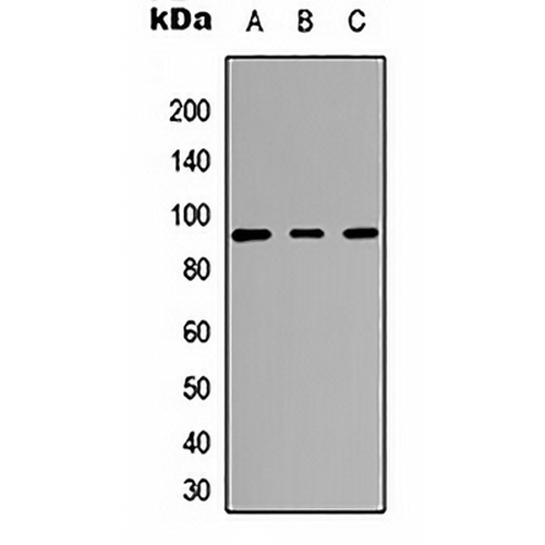 CARK Rabbit Polyclonal Antibody