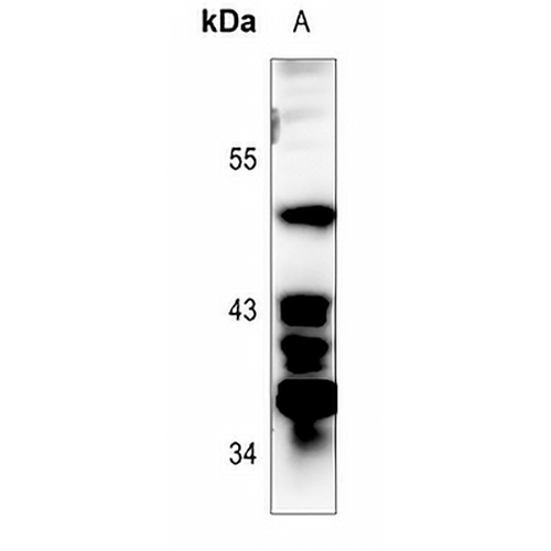 p53 (Phospho-S392) Rabbit Polyclonal Antibody